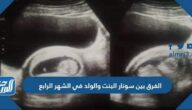 الفرق بين سونار البنت والولد في الشهر الرابع