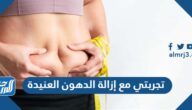 تجربتي مع إزالة الدهون العنيدة