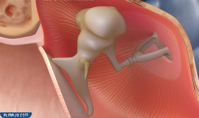 تصلب عظمة الركاب