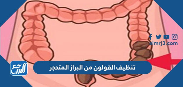 تنظيف القولون من البراز المتحجر