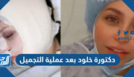 صور دكتورة خلود بعد عملية التجميل