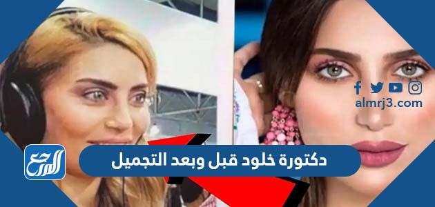 دكتورة خلود قبل وبعد التجميل