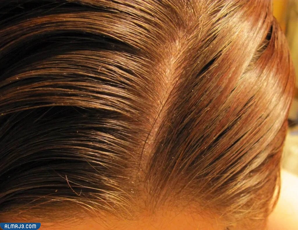 صبغة النسكافية والكركم