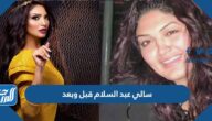 صور سالي عبد السلام قبل وبعد