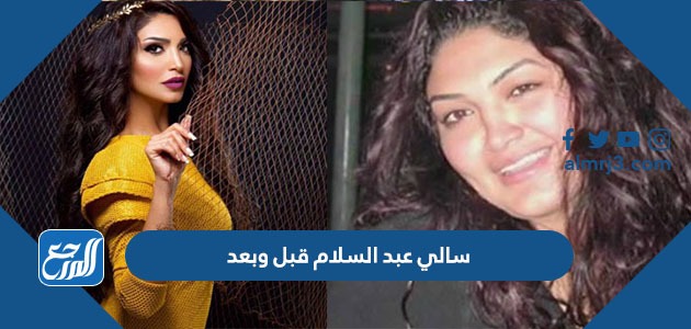 صور سالي عبد السلام قبل وبعد