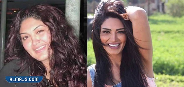 صور سالي عبد السلام قبل وبعد