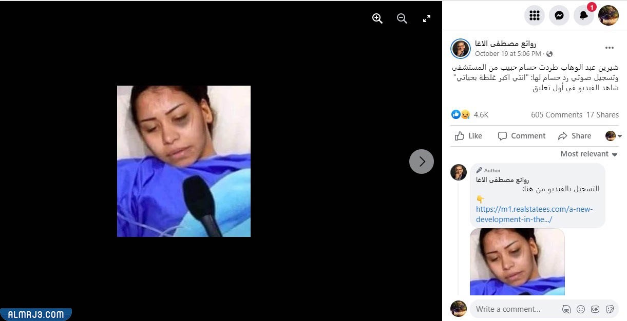 صور شيرين عبدالوهاب في المستشفى