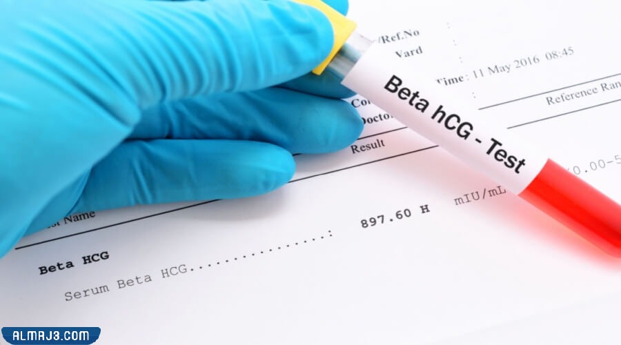 طريقة استخدام التحليل الرقمي للكشف عن التوأم