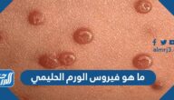 ما هو فيروس الورم الحليمي بالصور