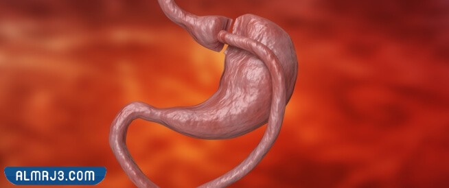 ما هي عملية تحويل المسار