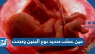 مين عملت تحديد نوع الجنين ونجحت