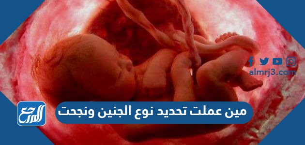 مين عملت تحديد نوع الجنين ونجحت