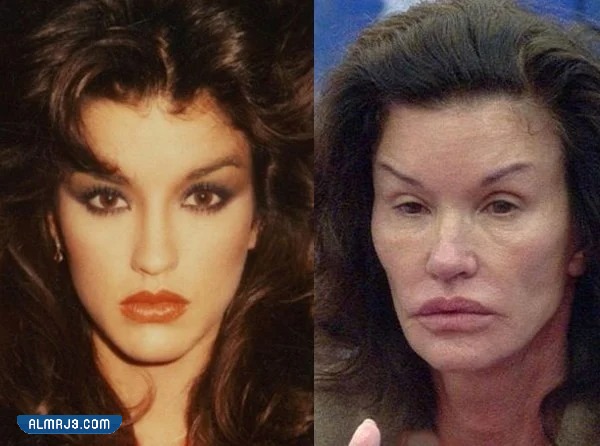 تجربتي الفاشله مع الفيلر