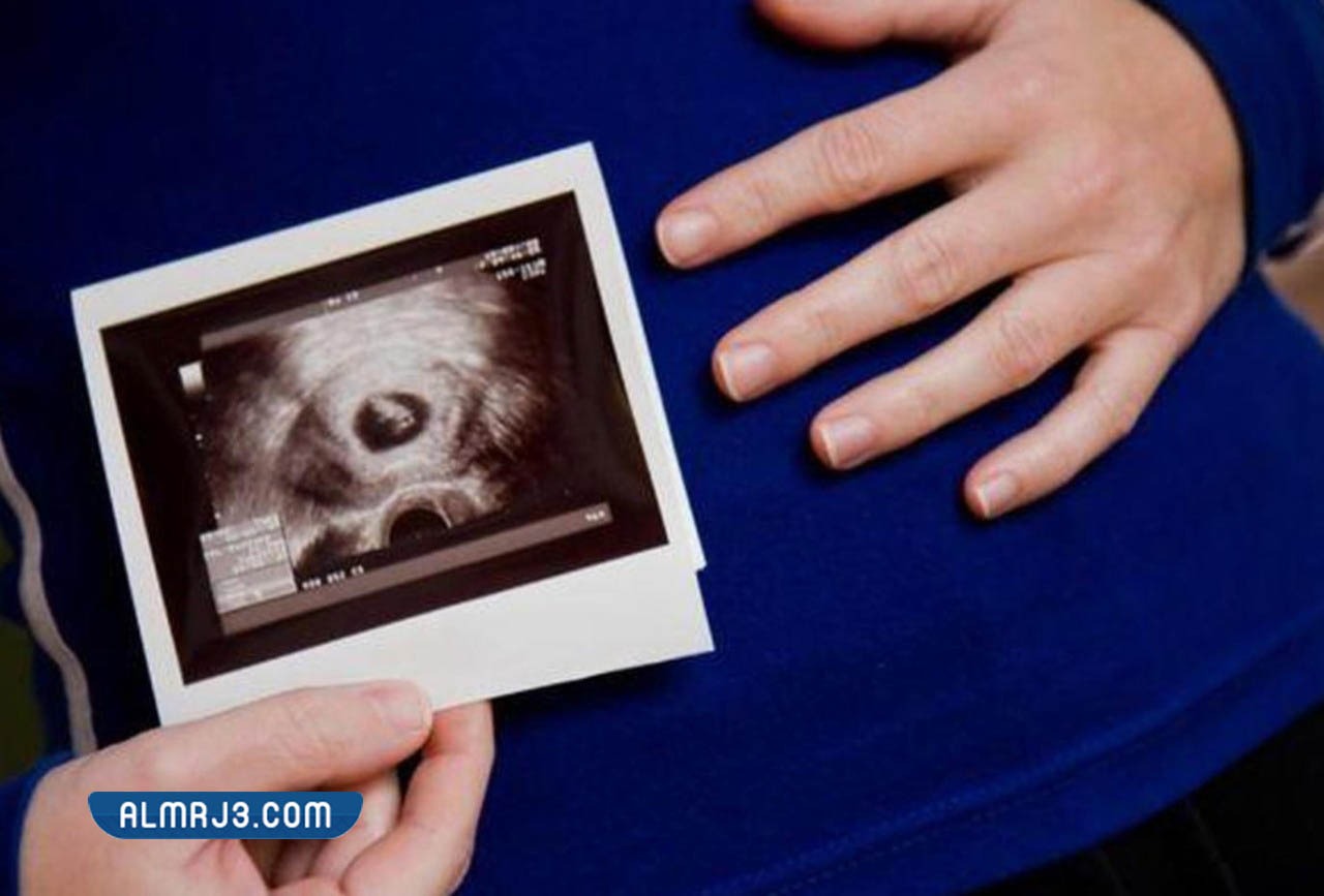 الطرق العلمية لمعرفة نوع الجنين