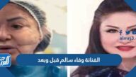 الفنانة وفاء سالم قبل وبعد