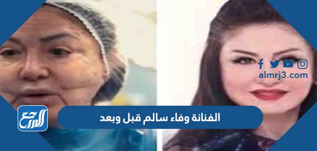الفنانة وفاء سالم قبل وبعد