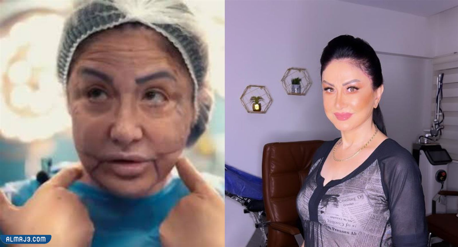 الفنانة وفاء سالم قبل وبعد