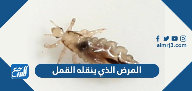 المرض الذي ينقلة القمل