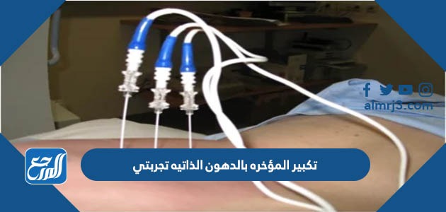 تكبير المؤخره بالدهون الذاتيه تجربتي