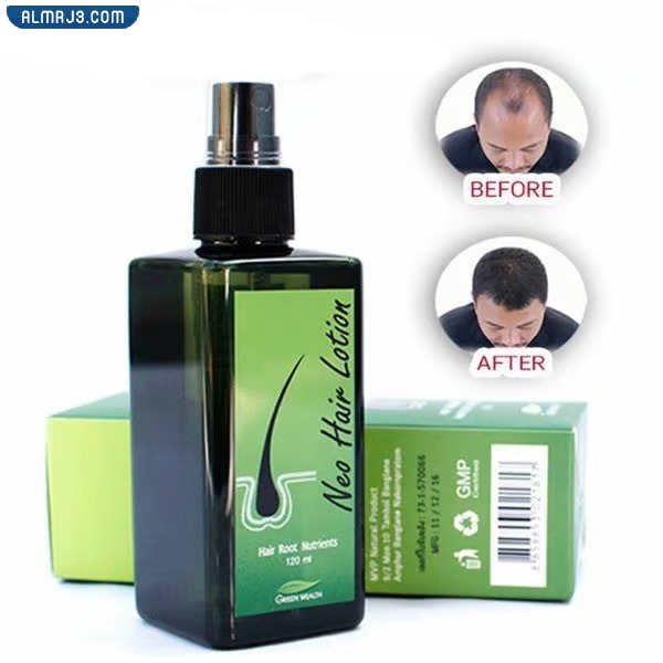 تجربتي مع نيو هير لوشن