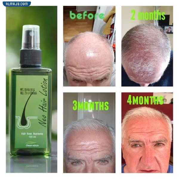 تجربتي مع نيو هير لوشن