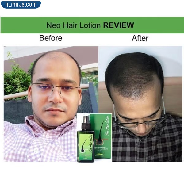 تجربتي مع نيو هير لوشن