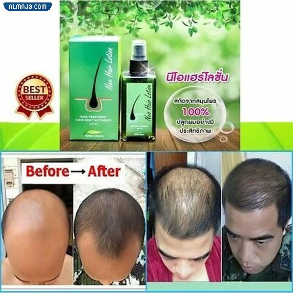 تجربتي مع نيو هير لوشن