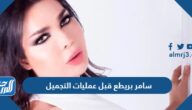 صور سامر بريطع قبل عمليات التجميل