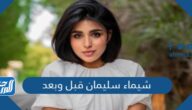 شيماء سليمان قبل وبعد