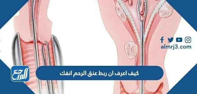 كيف اعرف ان ربط عنق الرحم انفك كيف اعرف ان ربط عنق الرحم انفك