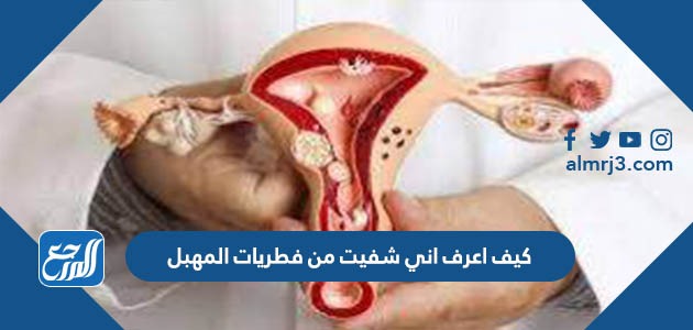 كيف اعرف اني شفيت من فطريات المهبل