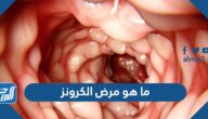ما هو مرض الكرونز وهل هو خطير