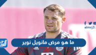ما هو مرض مانويل نوير حارس بايرن ميونخ