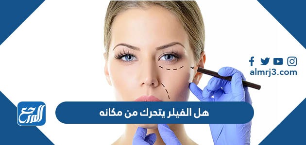 هل الفيلر يتحرك من مكانه