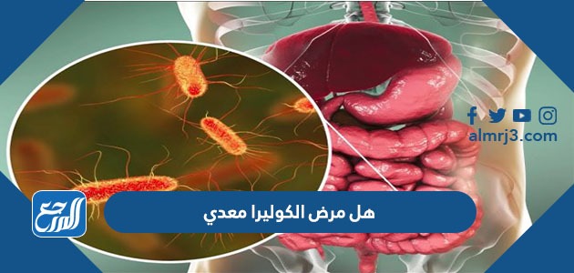 هل مرض الكوليرا معدي