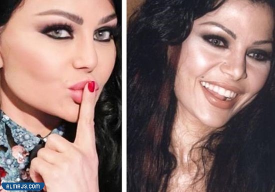 هيفاء وهبي قبل وبعد