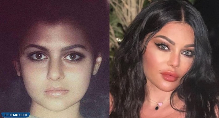 هيفاء وهبي قبل وبعد