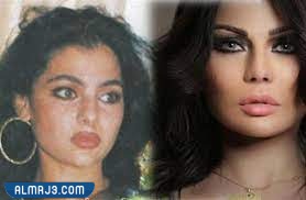 هيفاء وهبي قبل وبعد