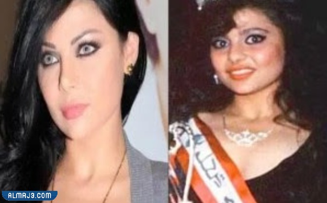 هيفاء وهبي قبل وبعد