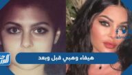 هيفاء وهبي قبل وبعد