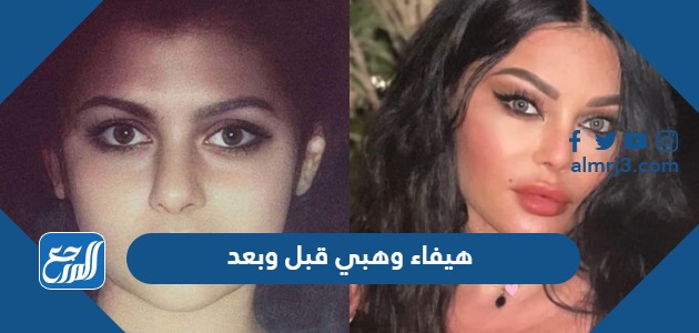 هيفاء وهبي قبل وبعد