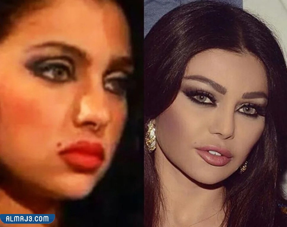 هيفاء وهبي قبل وبعد