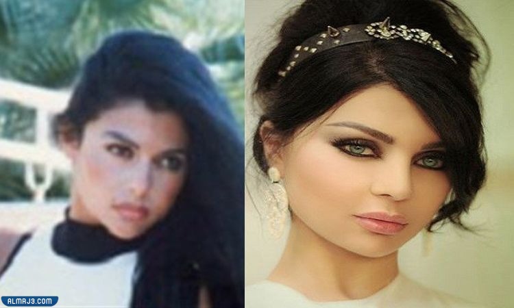 هيفاء وهبي قبل وبعد