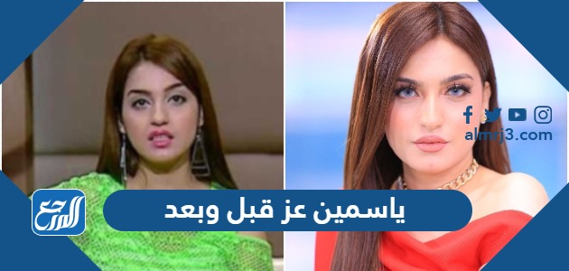ياسمين عز قبل وبعد