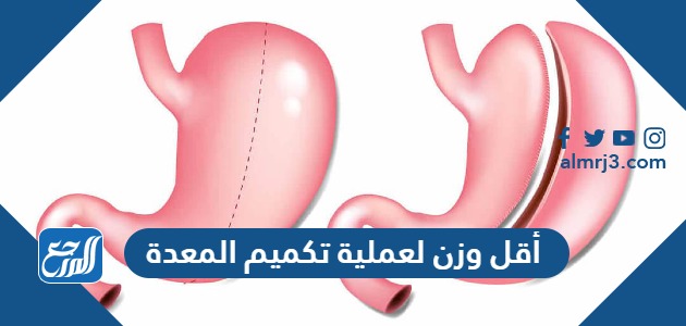 أقل وزن لعملية تكميم المعدة