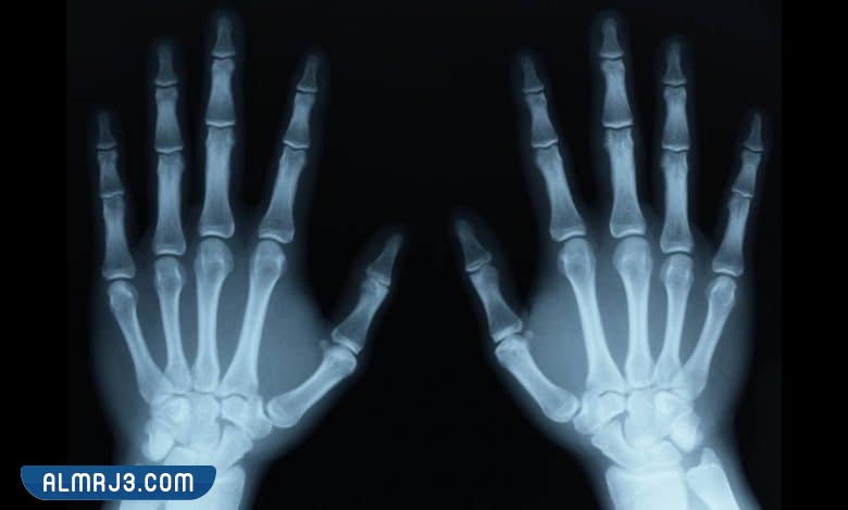 أنواع الأشعة السينية الطبية