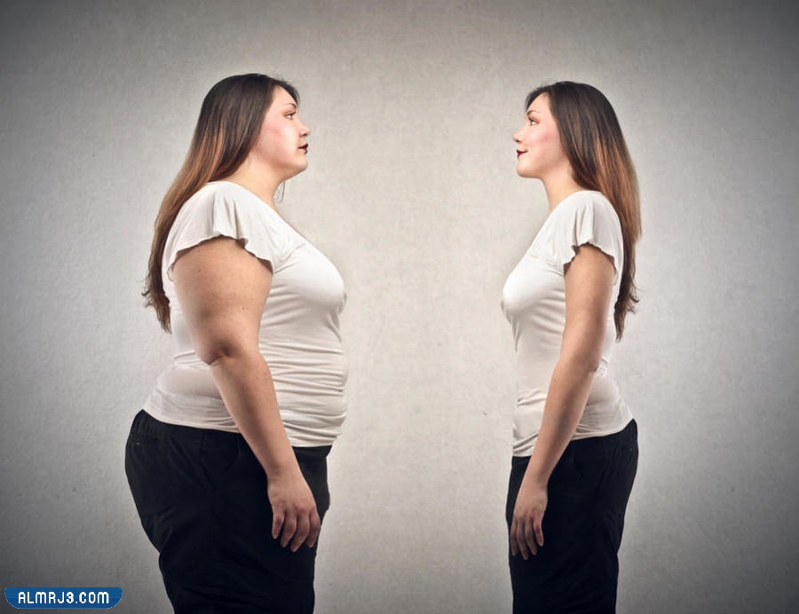 تكميم المعدة قبل وبعد 7