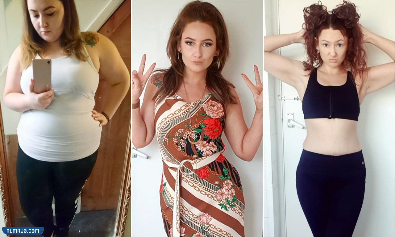 تكميم المعدة قبل وبعد 9