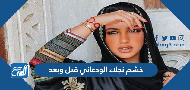 خشم نجلاء الودعاني قبل وبعد