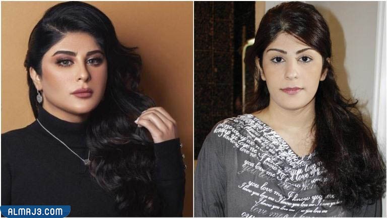 زارا البلوشي قبل وبعد التجميل